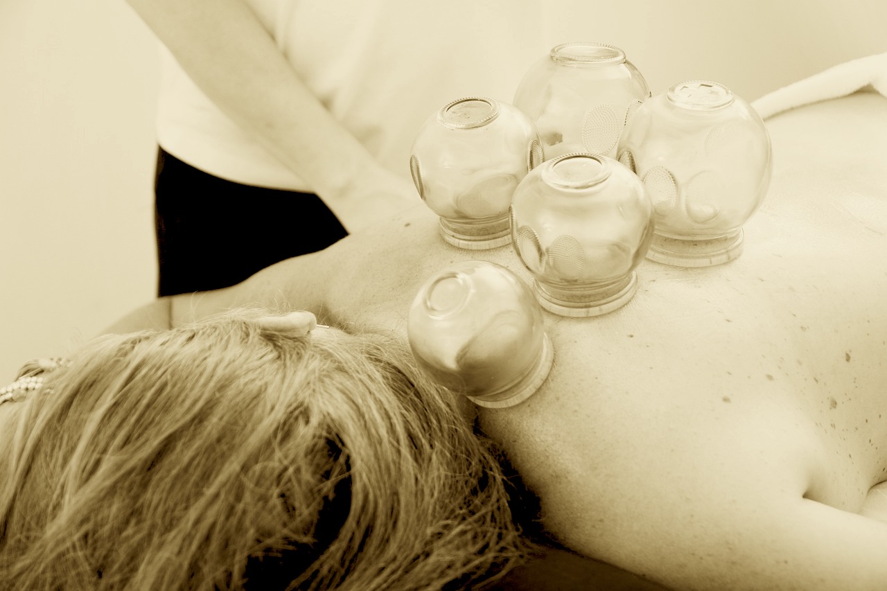 cupping ventouses